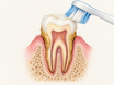 Cross-section of a tooth and gum showing soft plaque being brushed away from enamel while hard yellow-brown tartar remains firmly attached at the gumline and root, illustrating why brushing cannot remove hardened tartar.